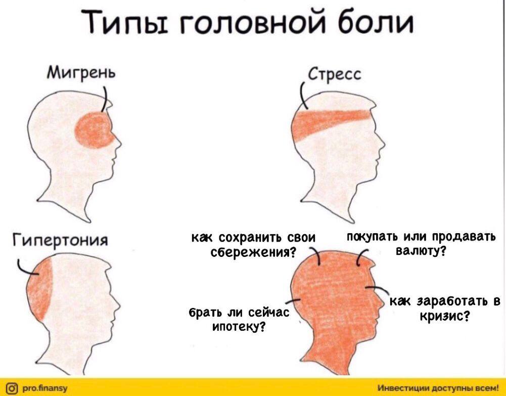 Виды головной боли в картинках