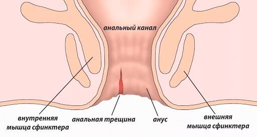 Последствия анального секса - 32 ответа на форуме pornase9.ru ()